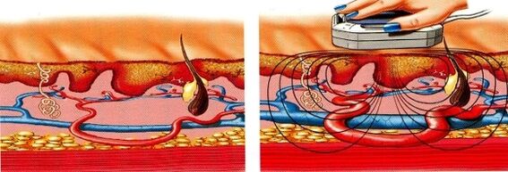 wenn Ihre Beine taub werden